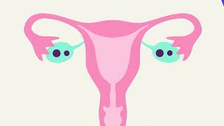 L Ring Contraceptive Method How Does It Work To Prevent Pregnancy?