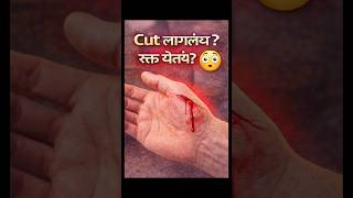 Cut लागलं तर काय करायचं? 😳 | First Aid Tips | Marathi Health।#shorts #skincare #facts #healthtips
