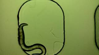 Live C. elegans in agarose micro-chamber