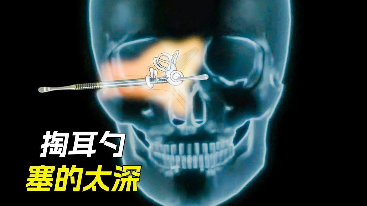掏耳勺塞的太深，拔不出來了怎麼辦，科幻，奇幻，電影，解說，獵奇，懸疑，冒險，搞笑，短片，short film