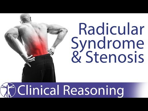 Lumbar Radicular Syndrome vs. Intermittent Neurogenic Claudication/Stenosis