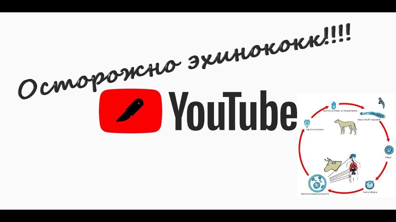 #Эхинококк #Эхинококкэктомия #Ход операции #Капитонаж #Лапаротомия по # ...