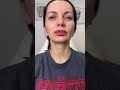 Full face-коррекция