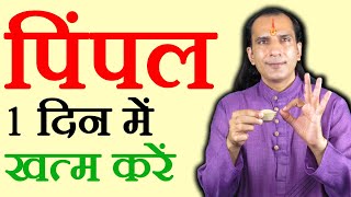 पिंपल का सिंपल इलाज - How To Cure Pimples by Sachin Goyal - Pimple ka ilaj screenshot 4