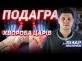 Подагра - захворювання царів? | Лікар Васильєв