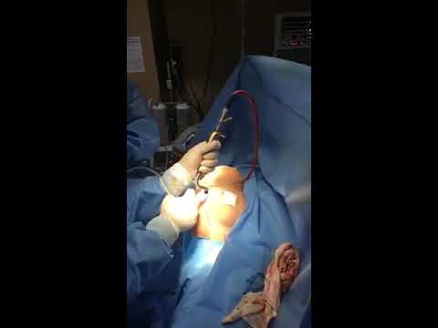 gummy-silicone-breast-augmentation-live-with-dr-jeneby