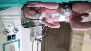"Adorable Baby Boy👶💗Diaper Change Moments "| Soft Cleaning & NICU Care #nicucare #diaper screenshot 5