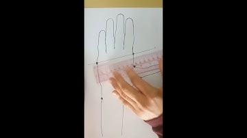 Volar cock up splint drawing