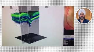 early detection of eye disease