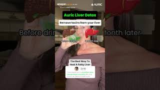 💧 Cleanse Your Liver Naturally | Auric Liver Detox Effervescent Tablets