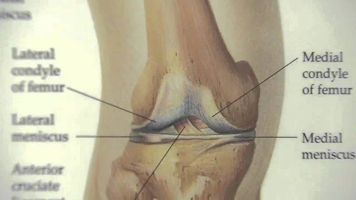 Kicking Knee Pain with Cartilage Replacement