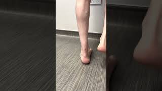 Ruptured Achilles Tendon Recovery 8 Months After Surgery