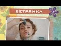 Ветрянка у взрослых