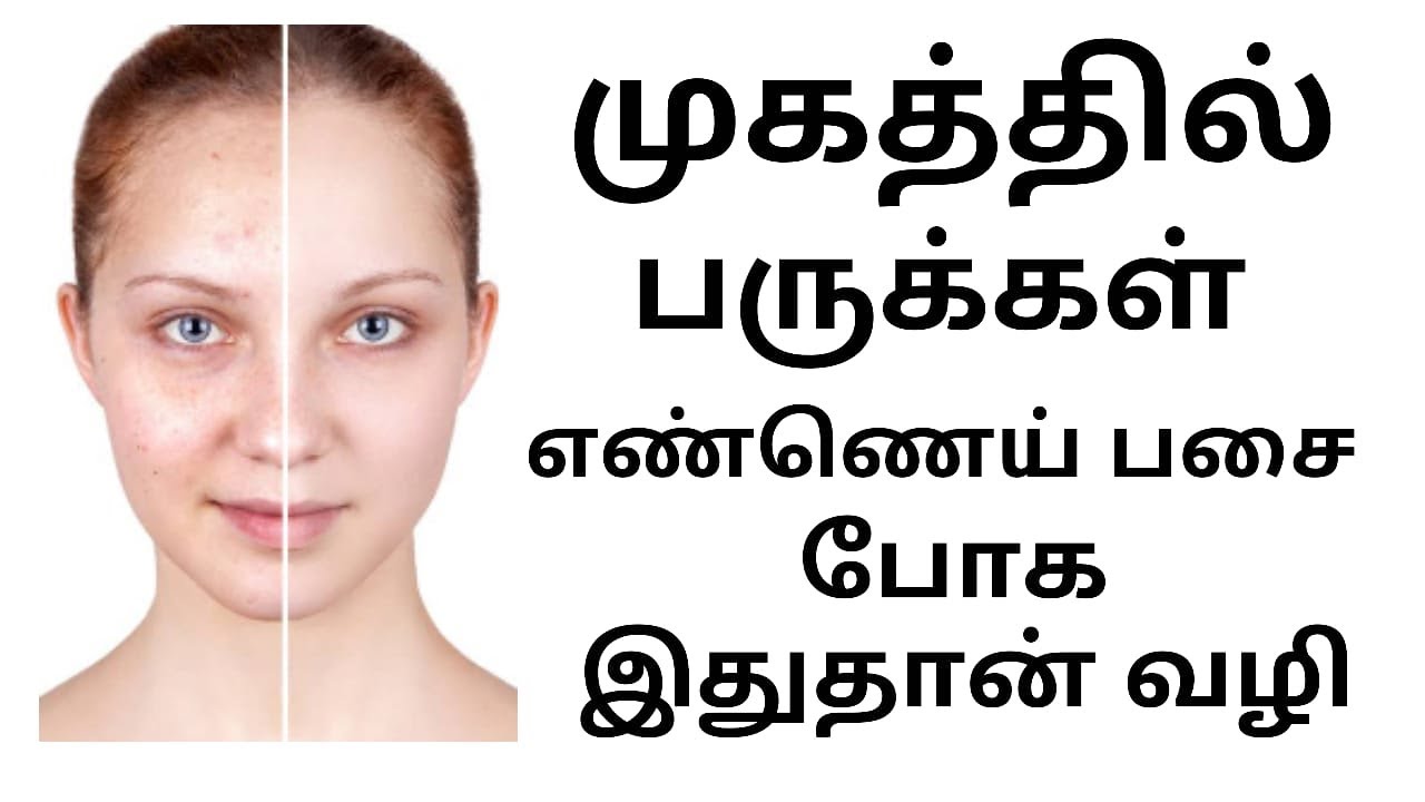 Home remedies for pimples - Beauty Tips in Tamil ...