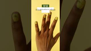 Bid Farewell To Nail Fungus Permanently By Adopting These Habits And Following These Tips