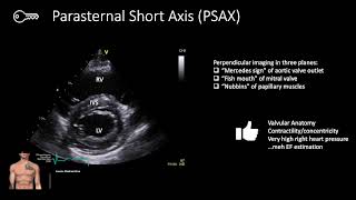 POCUS Cardiac Windows | Master the 4 Essential Views