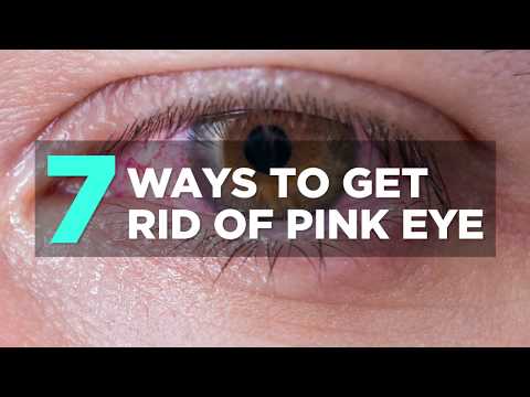 Video: Den enkleste måten å bli kvitt rosa øyne raskt