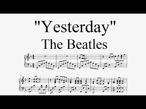 «Yesterday» - The Beatles (շապիկ տարբերակ)