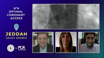 A patient undergoing TAVI - how should I achieve optimal coronary access? - Webinar