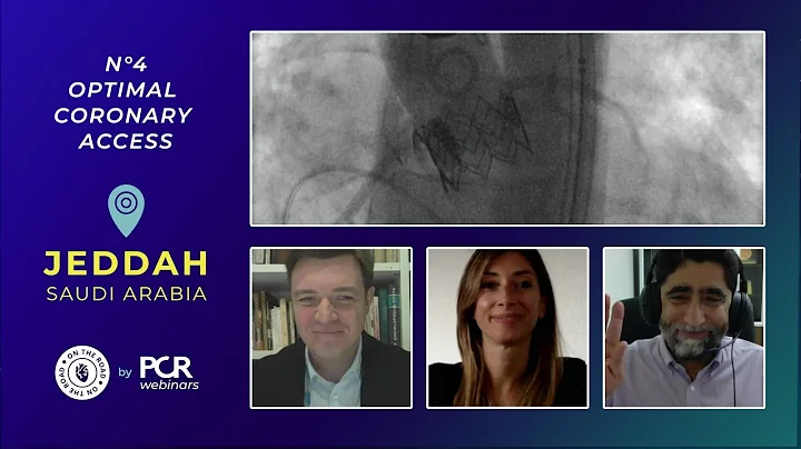 A patient undergoing TAVI - how should I achieve optimal coronary access? - Webinar