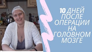 10 дней после операции на головном мозге.  Проблемы с дексаметазоном.