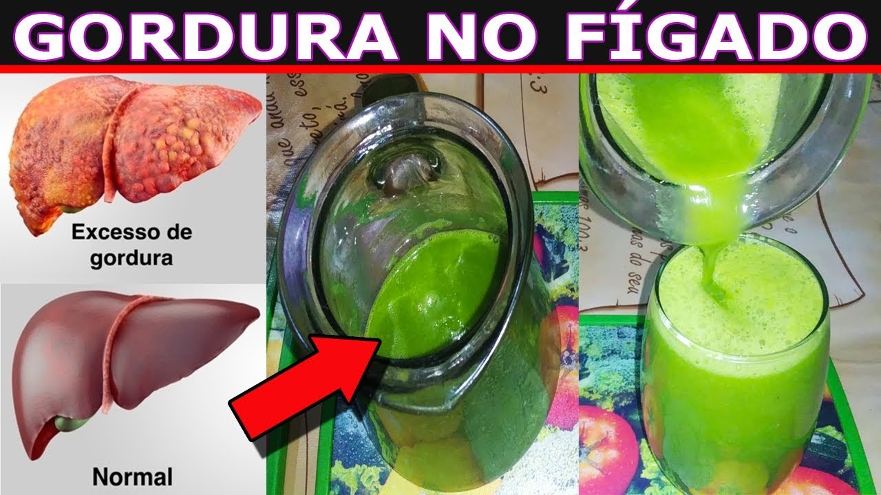 Como Eliminar Gordura No Figado Rapido