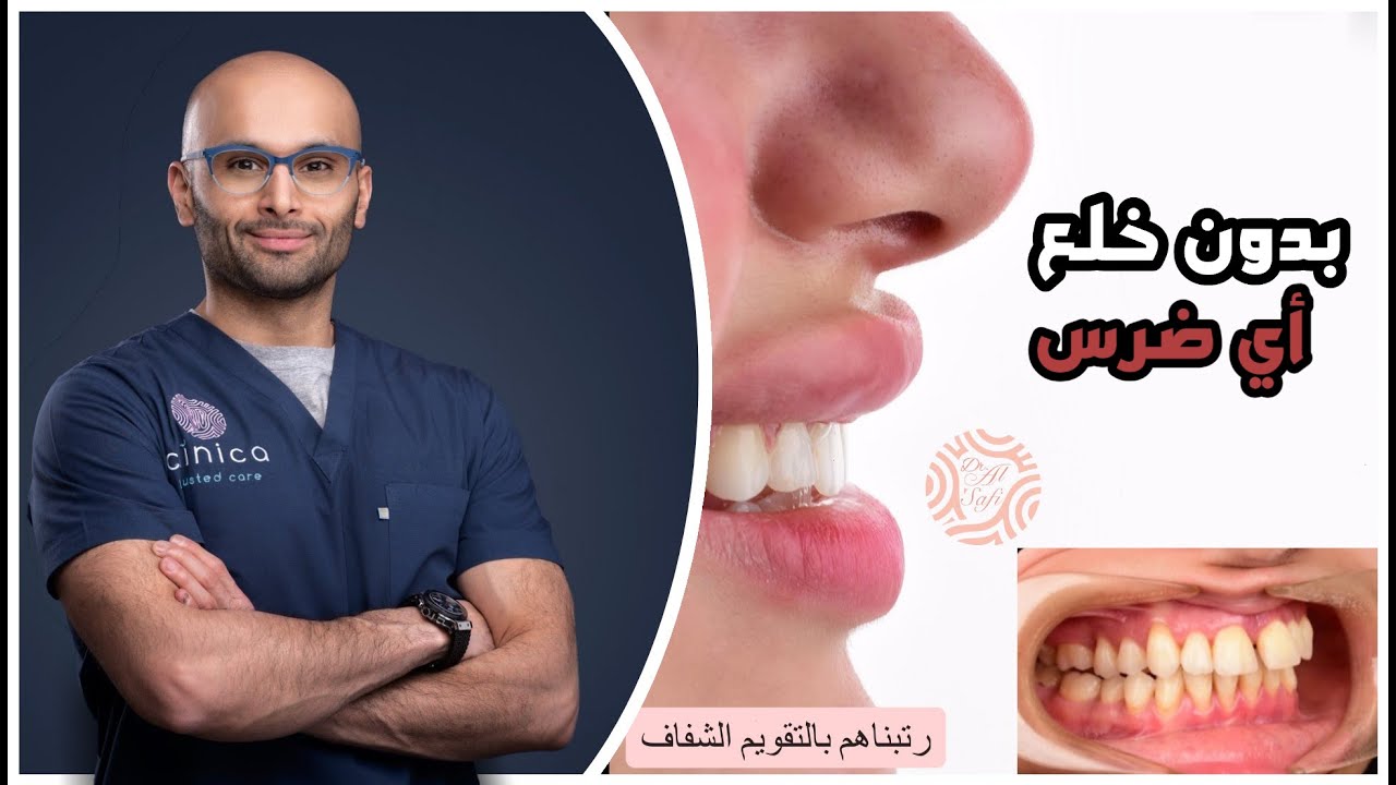 علاج بروز الأسنان بالتقويم الشفاف | الدكتور محمد نبيل الصافي