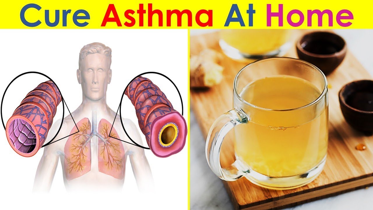 How to Treat Asthma Naturally Cure Asthma with Foods & Remedies YouTube