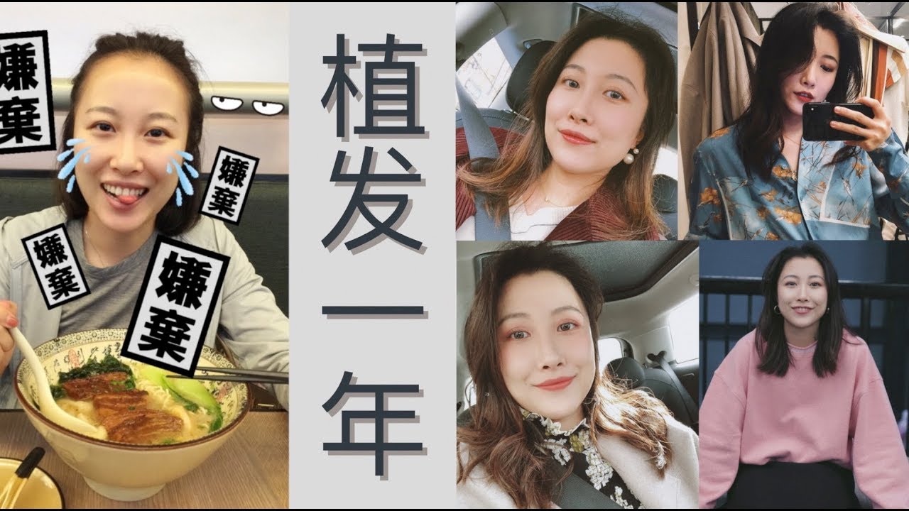 植发1年啦 一次回答你们所有的问题 Olivia Youtube 植发1年啦 一次回答你们所有的问题 Olivia Youtube