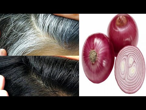 Onion দিয়ে সাদা চুলকে দ্রুত কালো করার উপায় !! Super Fast Hair Growth Challenge!