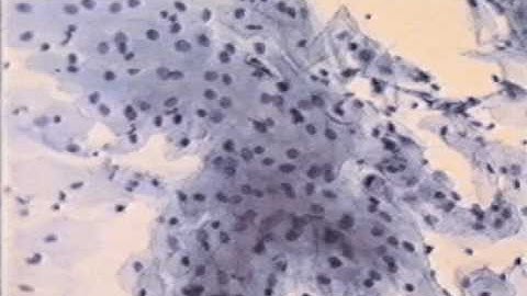 Pap Smear Motion Parallax edge 3D microscope