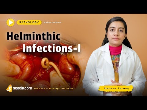 Video: Helminthiasis Pri Ljudeh - Simptomi In Zdravljenje črvov, Diagnoza