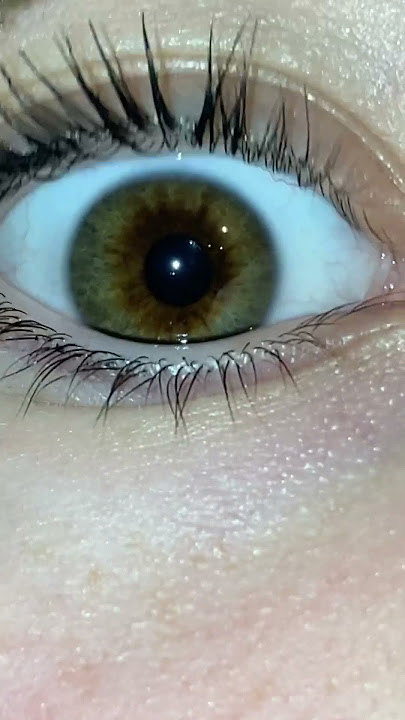 I think I have hazel