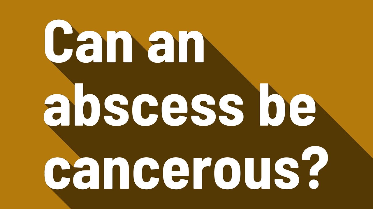 Can an abscess be cancerous? - YouTube