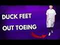 Duck Feet, Duck Toe, Out Toeing HELPED by Dr Suh Chiropractic