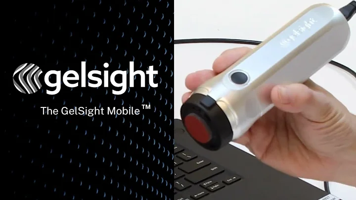 The GelSight Mobile™