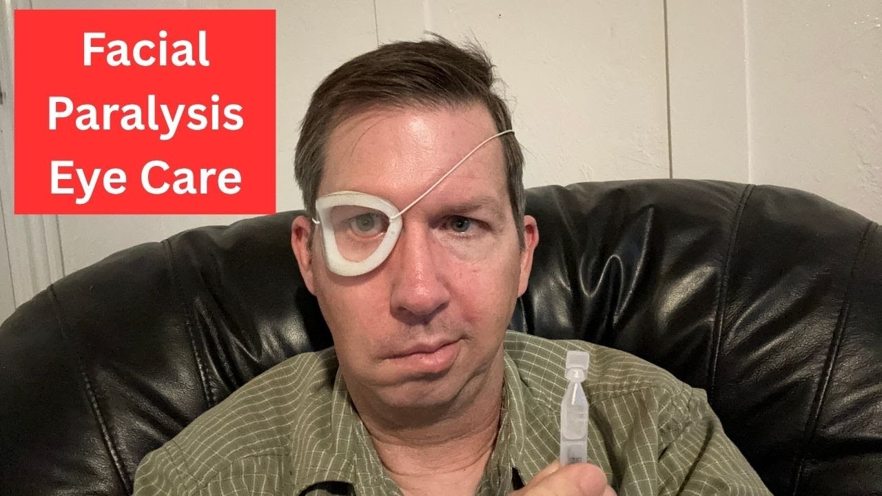 Уход за глазами при параличе лицевого нерва