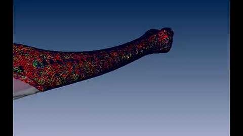 Amira | 3D visualization and analysis | 3D Bone Reconstruction