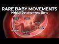 Rare Baby Movements in the Womb | Hidden Signs of Fetal Development