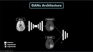 Team 17   Synthesizing Missing MRI Sequences Towards Reliable Semantic Segmentation of Brain Tumors