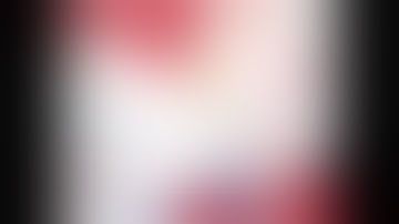 Gastric GIST - ESD/ Mucosal flap creation and Loop and clip closure