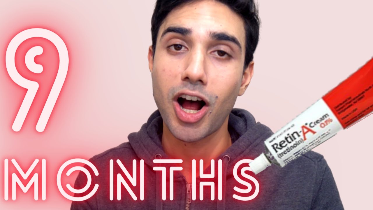 9 Months on Tretinoin (Retin-A) - YouTube