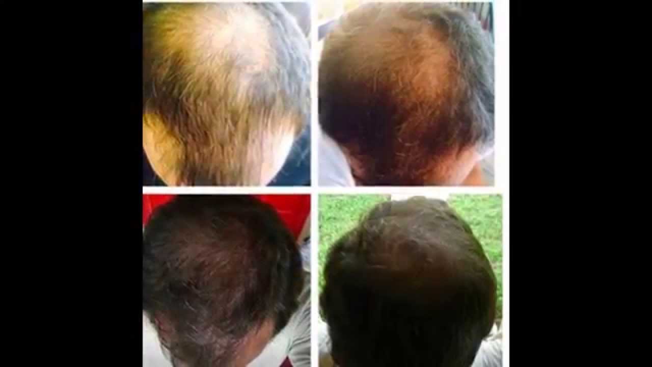 Results 39 Days On Hair Skin Nails It Works YouTube