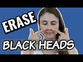 Erase blackheads: dermatologist tips| Dr Dray