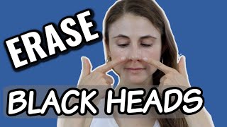Erase blackheads: dermatologist tips| Dr Dray