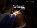 Mole removal painless treatment #delhi #moleremoval #skin #yt #ytshorts #trendinhshorts