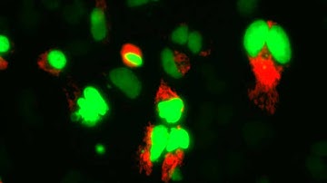 Time Lapse Imaging of Dividing HeLa Cells