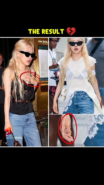 ROSÉ's stage accidents during the Deadline tour... 💔🥀 #rosé #blackpink #deadline #shorts