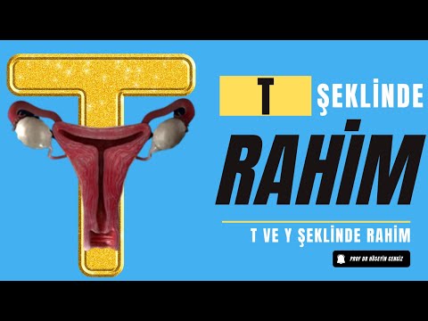 T ŞEKLİNDE RAHİM 💥(RAHİM ANOMALİLERİ)- Y ŞEKLİNDE RAHİM- PROF DR HÜSEYİN CENGİZ