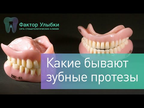 Зубные протезы - какие протезы бывают и какие протезы лучше выбрать?